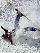 Травма при спуске на горных лыжах